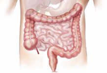 Nuovo batterio coreano nel microbioma intestinale di un paziente con SLA