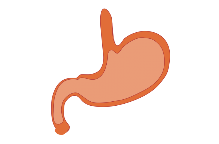 Tumore dello stomaco, disponibile in Italia trifluridina-tipiracil