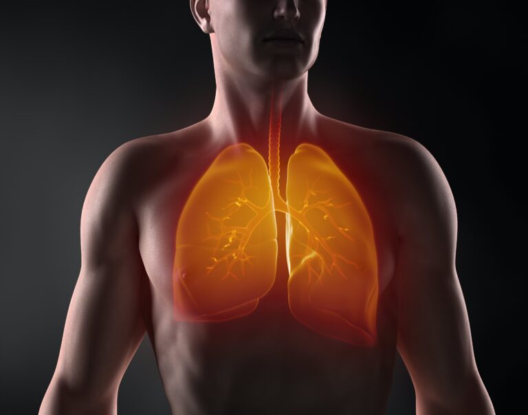 Carcinoma NSCLC: ruolo della proteina CRIPTO nella resistenza alla chemioterapia