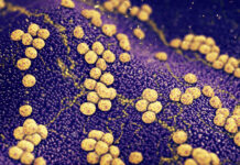 Strategie liposomiali avanzate contro l’MRSA