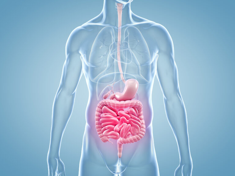 Malattie infiammatorie intestinali, nuovi dati su ustekinumab