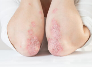 Lavoro di squadra per terapie sostenibili