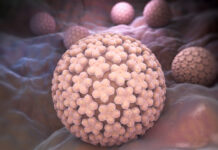 Farmaco oncologico contro la papillomatosi tracheale: studio dell’Ospedale Mauriziano