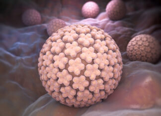 Farmaco oncologico contro la papillomatosi tracheale: studio dell’Ospedale Mauriziano