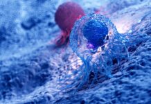 Come i grassi del tumore ostacolano le difese immunitarie: individuato meccanismo