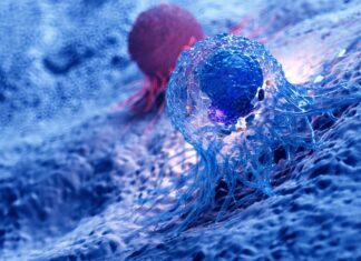 Come i grassi del tumore ostacolano le difese immunitarie: individuato meccanismo