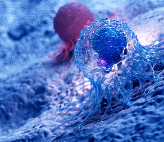 Come i grassi del tumore ostacolano le difese immunitarie: individuato meccanismo