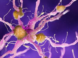 Alzheimer: nanoparticelle d’oro per veicolare il litio nel cervello