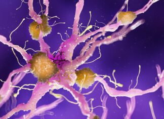 Alzheimer: nanoparticelle d’oro per veicolare il litio nel cervello