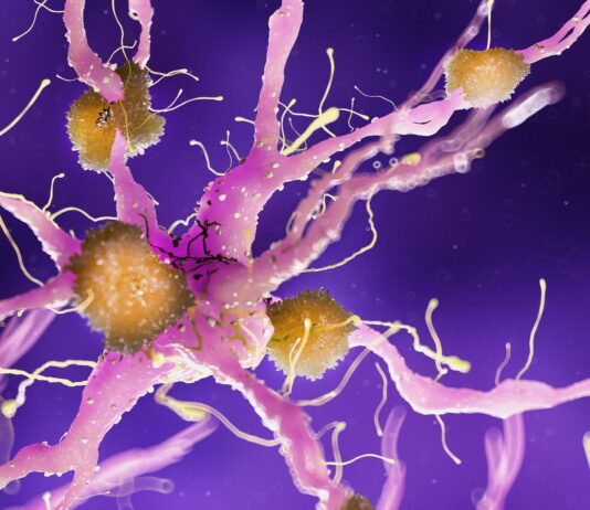 Dream esplora il rapporto tra ambiente e malattie neurodegenerative
