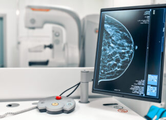 Tumore al seno: ricercatori IEO ottengono profilo epigenetico