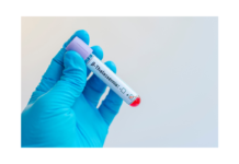 Il presente e il futuro della talassemia, dalla trasfusione alla terapia genica