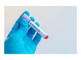 Il presente e il futuro della talassemia, dalla trasfusione alla terapia genica