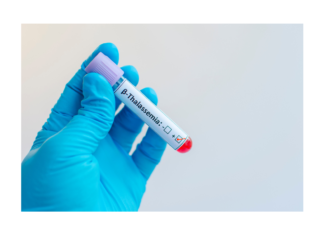 Sindromi talassemiche, come cambia il paradigma di cura