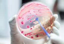 Gestione dell’asepsi cutanea nuova normativa sui biocidi