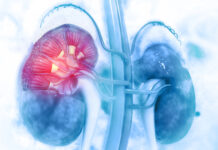 Malattia renale cronica, nasce il progetto Premio per la diagnosi precoce