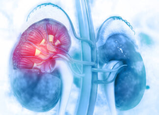 Malattia renale cronica, nasce il progetto Premio per la diagnosi precoce
