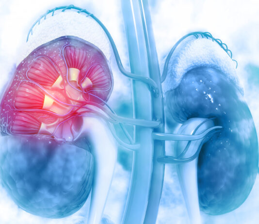 Malattia renale cronica, nasce il progetto Premio per la diagnosi precoce
