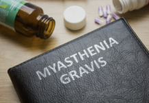Miastenia grave, la medicina di precisione rivoluziona l’approccio