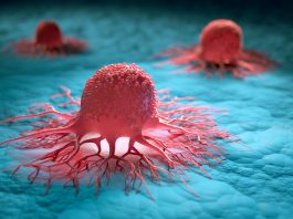 Tumori: divari geografici e di genere in Europa