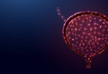 Una nuova strategia contro il carcinoma della vescica non muscolo-invasivo ad alto rischio