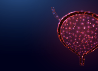 Una nuova strategia contro il carcinoma della vescica non muscolo-invasivo ad alto rischio