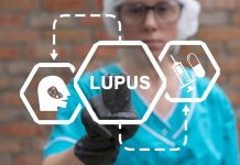 Lupus eritematoso sistemico e rischio cardiovascolare, nuove evidenze scientifiche