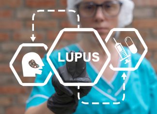 Lupus eritematoso sistemico e rischio cardiovascolare, nuove evidenze scientifiche
