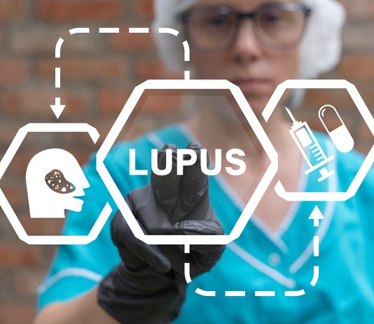 Lupus eritematoso sistemico e rischio cardiovascolare, nuove evidenze scientifiche