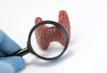 Ipoparatiroidismo: quadro clinico e prospettive terapeutiche