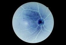 Patologie retiniche: CHMP approva estensione intervallo di trattamento per aflibercept 8 mg