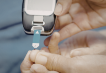 L’uso della tirzepatide nelle ipoglicemie refrattarie