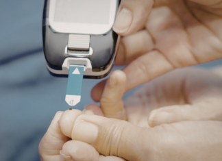 L’uso della tirzepatide nelle ipoglicemie refrattarie