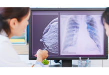 Tumore al seno in pre-menopausa: prolungare la terapia ormonale riduce recidive e metastasi Dottoressa che spiega a una paziente immagini ecografiche nel percorso di monitoraggio del tumore al seno