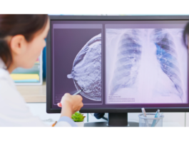 Tumore al seno in premenopausa: prolungare la terapia ormonale riduce recidive e metastasi Dottoressa che spiega a una paziente immagini ecografiche nel percorso di monitoraggio del tumore al seno