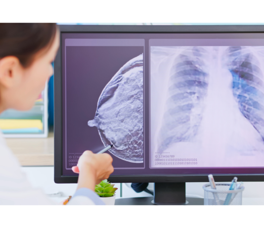 Tumore al seno in pre-menopausa: prolungare la terapia ormonale riduce recidive e metastasi Dottoressa che spiega a una paziente immagini ecografiche nel percorso di monitoraggio del tumore al seno