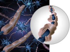 La lotta alla sclerosi multipla riparte da Regione Lombardia sclerosi multipla Pdta Agenas Regione Lombardia