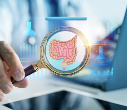 Sindrome di Lynch, Fondazione Onda: servono screening universali e Pdta uniformi Libro bianco Fondazione Onda sindrome di Lynch