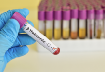 Beta-talassemia in Italia, verso una strategia nazionale integrata betatassemia