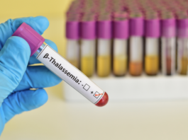 Beta-talassemia in Italia, verso una strategia nazionale integrata betatassemia