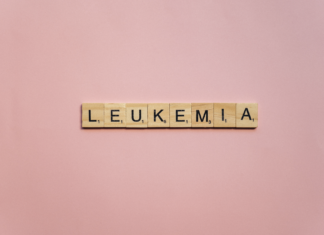 Leucemia infantile, come le cellule sopravvivono per anni prima di diventare tumore Leucemia infantile