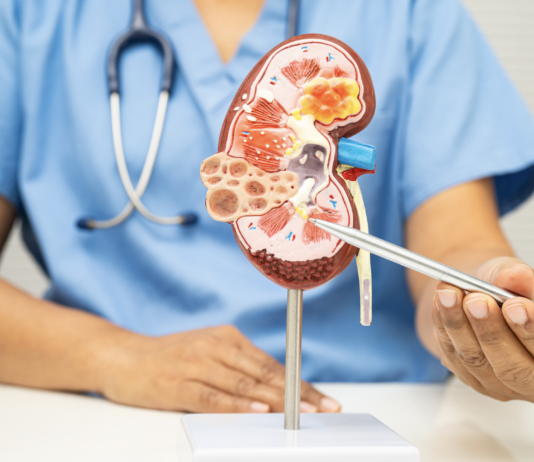 Malattia renale cronica, nuove terapie allontanano la dialisi malattia renale cronica