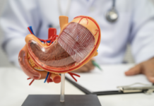 Tumore dello stomaco avanzato HER-2 negativo, nuova combinazione di farmaci dallo studio Ilustro tumore stomaco avanzato HER-2 negativo