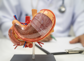 Tumore dello stomaco avanzato HER-2 negativo, nuova combinazione di farmaci dallo studio Ilustro tumore stomaco avanzato HER-2 negativo