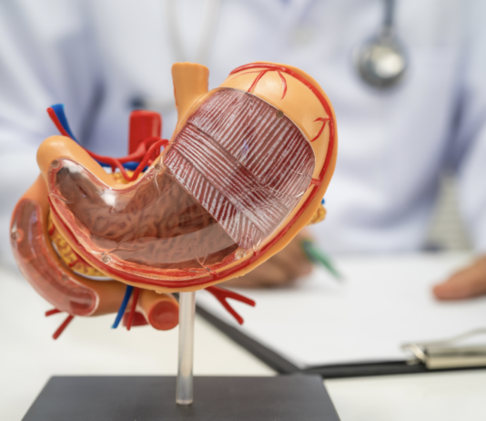 Tumore dello stomaco avanzato HER-2 negativo, nuova combinazione di farmaci dallo studio Ilustro tumore stomaco avanzato HER-2 negativo