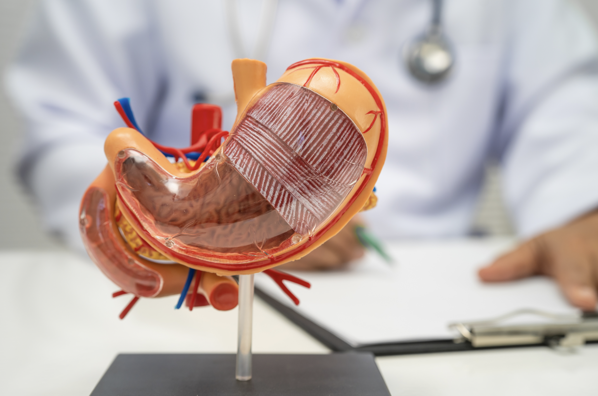 Tumore dello stomaco avanzato HER-2 negativo, nuova combinazione di farmaci dallo studio Ilustro