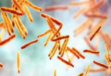 Gestione della tubercolosi: analisi epidemiologica, nuove tecniche diagnostiche e perduranti criticità