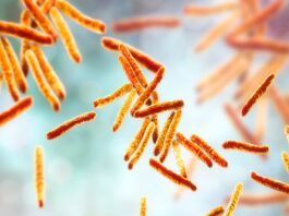 Gestione della tubercolosi: analisi epidemiologica, nuove tecniche diagnostiche e perduranti criticità