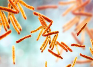 Gestione della tubercolosi: analisi epidemiologica, nuove tecniche diagnostiche e perduranti criticità