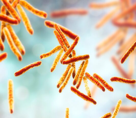 Gestione della tubercolosi: analisi epidemiologica, nuove tecniche diagnostiche e perduranti criticità